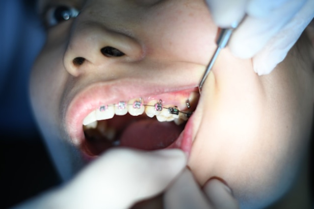 Orthodontie pour adultes